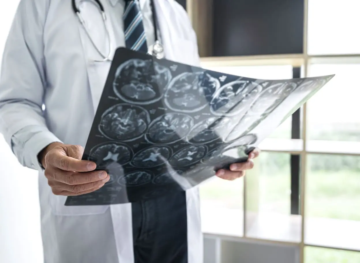 Idrocefalo normoteso, diabete mellito, ipertensione arteriosa sistemica
