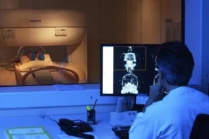 diagnostica per immagini idrocefalo normoteso idiopatico stroke volume