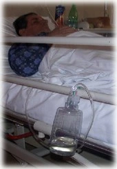 idrocefalo normoteso idiopatico test selezione DSP