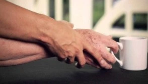 parkinson idrocefalo normoteso idiopatico cetin neurodegenerativa